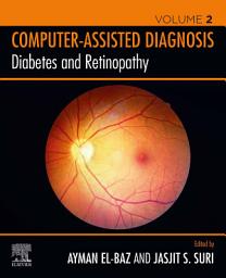 Icon image Diabetes and Retinopathy