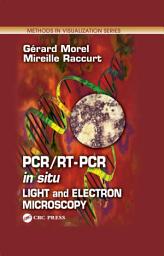 Icon image PCR/RT- PCR in situ: Light and Electron Microscopy