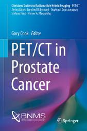 Icon image PET/CT in Prostate Cancer