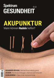 Icon image Spektrum Gesundheit- Akupunktur: Wann können Nadeln helfen?